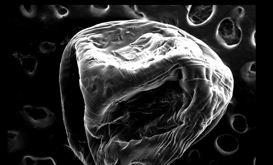 Pectin carriers unleash army of predatory bacteria | The Microbiologist