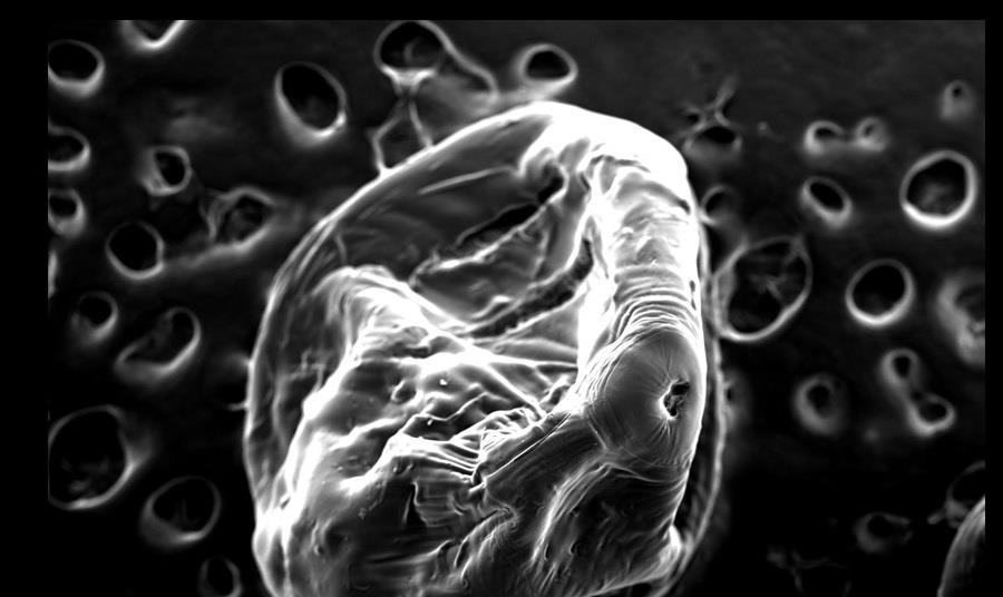 Pectin carriers unleash army of predatory bacteria | The Microbiologist