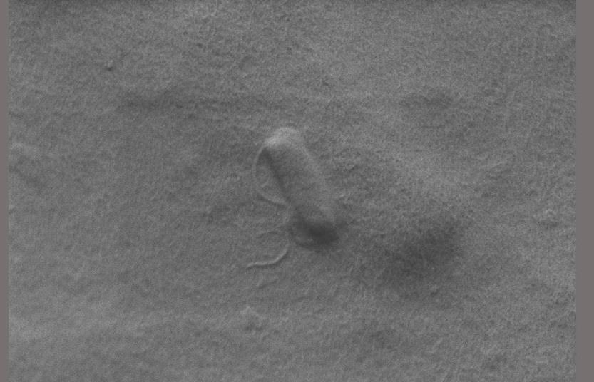 Pectin carriers unleash army of predatory bacteria | The Microbiologist