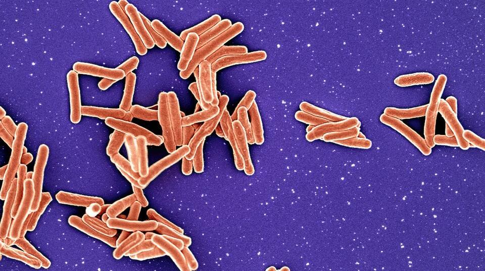 Photo: the-microbiologist.com Mycobacterium_Tuberculosis_Bacteria
