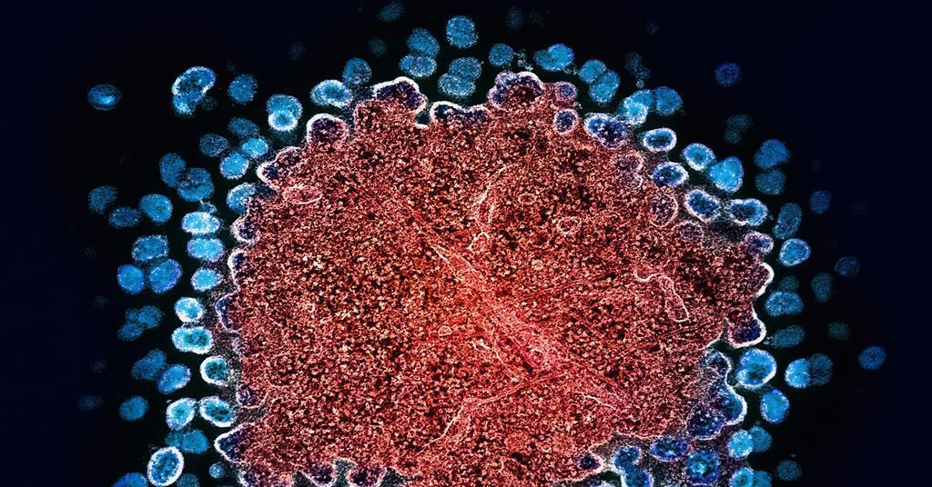 Researchers a step closer to a cure for HIV | News | The Microbiologist