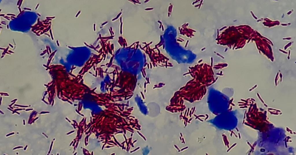 11632_mycobacterium_leprae_in_