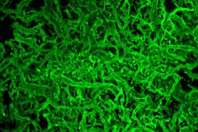 【超貴重プロモ盤】 BACTERIA / LOST Efficient oil-eating bacteria cooperate to maximize dining