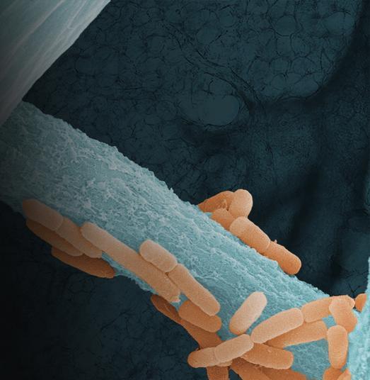 When fungi take your breath: How a mold can unbalance the lungs | News ...