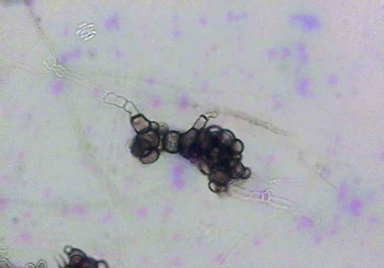 Fungi utilize ancient antimicrobial proteins to attack hosts and their ...