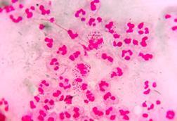 Neisseria_gonorrhoeae_in_urethral_discharge