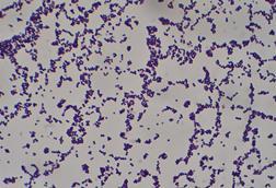Staphylococcus_aureus_Gram_stain (2)