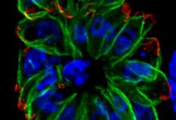 Humans_fibroblasts_infected_with_a_mutant_of_the_intracellular_parasite_Toxoplasma_gondii_-_image.pbio.v10.i12.g001