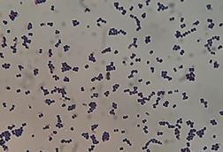Leuconostoc_mesenteroides_Gram_Staining