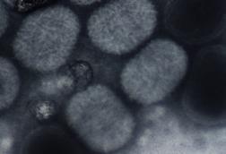 Molluscum_contagiousum_virus_(negative_staining)