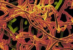Ebola_Virus_From_Mali_Blood_Sample_(16465524896)