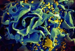 HIV-infected_T_cell_(6813489183)