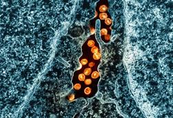 HIV_Virus_Particles_-_2