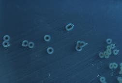 Salmonella_enterica_serovar_typhimurium_01