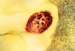 Measles_Virus_Particle