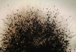 Aspergillus_fumigatus_microscope_view