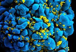 HIV-infected_T_cell_(6813384933)