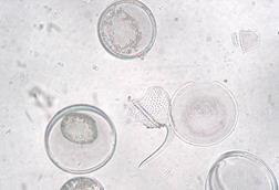 Coscinodiscus_granii