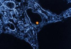 West_Nile_Virus_-_53865578133