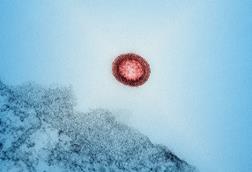HIV-1_Virus_Particle_-_53587553684