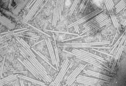 TMV_virus_under_magnification