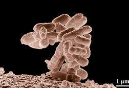E_coli_at_10000x,_original
