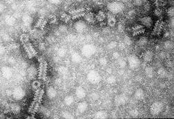 Mumps_virus_electron_micrograph