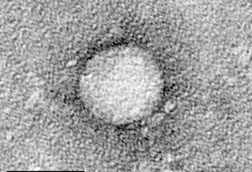 HCV_EM_picture_2