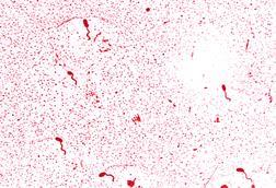 Vibrio_cholerae_01