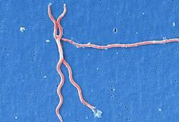 Lyme_disease_parasite_Borrelia_burgdorferi (1)