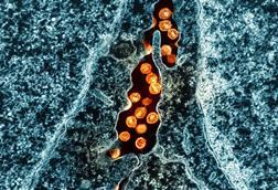 HIV_Virus_Particles_-_2 (1)