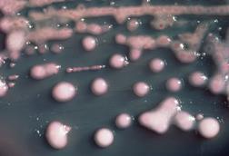 Klebsiella_pneumoniae_01 (1)