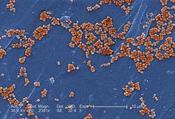 Methicillin-resistant_Staphylococcus_aureus_10048 (1)