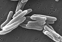 Mycobacterium_tuberculosis