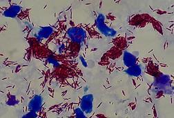 Mycobacterium_leprae_in_Magnification_of_4000X