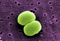 scanning-electron-micrograph-of-two-staphylococcus-epidermidis-bacteria-1536x904