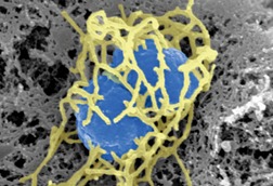 Neisseria_meningitidis_Charles-Orszag_2018
