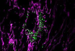 Low-Res_rehman-lab-mitokeima-hlmvec-oa-maggreen