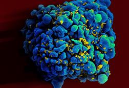 HIV-infected_H9_T_cell_(6813396647)