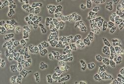 Low-Res_Acanthamoeba