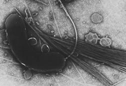 960px-Vibrio_cholerae (1)