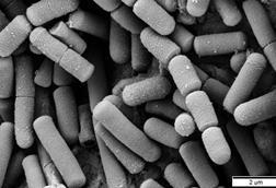 Bacillus_cereus_SEM-cr