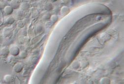 Aspergillus_ustus_Hulle_cell