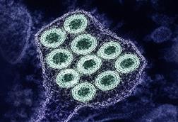 Colorized_transmission_electron_micrograph_of_rabies_virus_particles_(green)_image_captured_at_the_NIAID_Integrated_Research_Facility_in_Fort_Detrick,_Maryland_-_1
