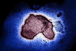 Human_Respiratory_Syncytial_Virus_(RSV)_-_2111