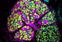 Low-Res_Infected_bacteriome__Ronja_Kruesemer