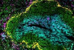 Low-Res_efecte-vacunes-mes-enlla-infeccio