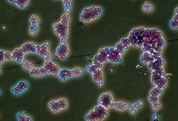 Candida_albicans_(251_12)