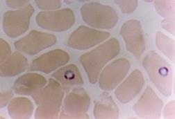 Plasmodium_falciparum_in_Red_Blood_Cells