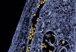 West_Nile_Virus_particles